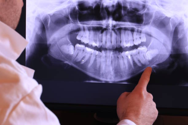 Best Weekend Emergency Dentist in Mount Morris, MI