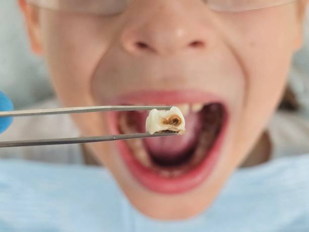 Best Emergency Dental Surgery in Mount Morris, MI